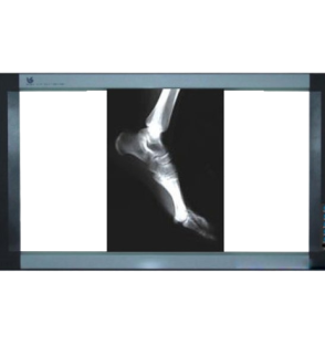 X-ray Viewers – Clear & Accurate Diagnostic Imaging Display