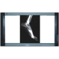 X-ray Viewers – Clear & Accurate Diagnostic Imaging Display