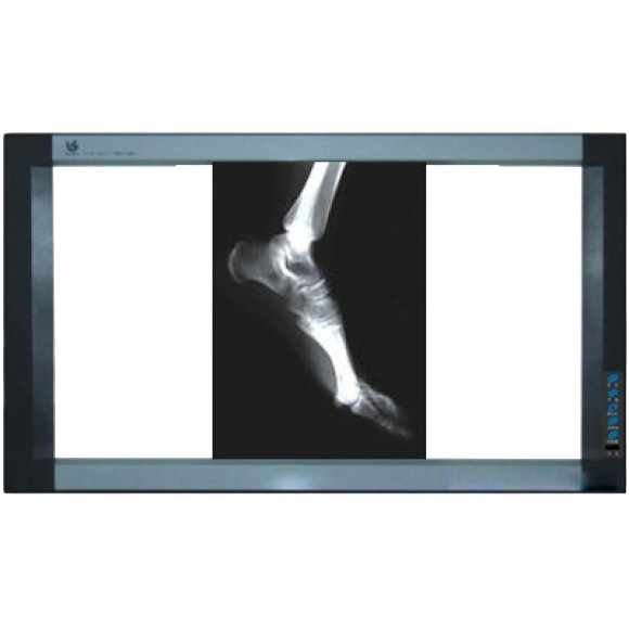 X-ray Viewers – Clear & Accurate Diagnostic Imaging Display